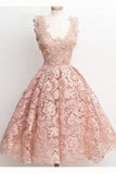 Short Scoop-Neck Lace Black Little Dresses Homecoming Dresses TR0034 - Tirdress